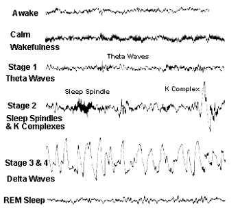 Effect of partial sleep deprivation on sleep stages and EEG power spectra: evidence for non-REM and REM sleep homeostasis.